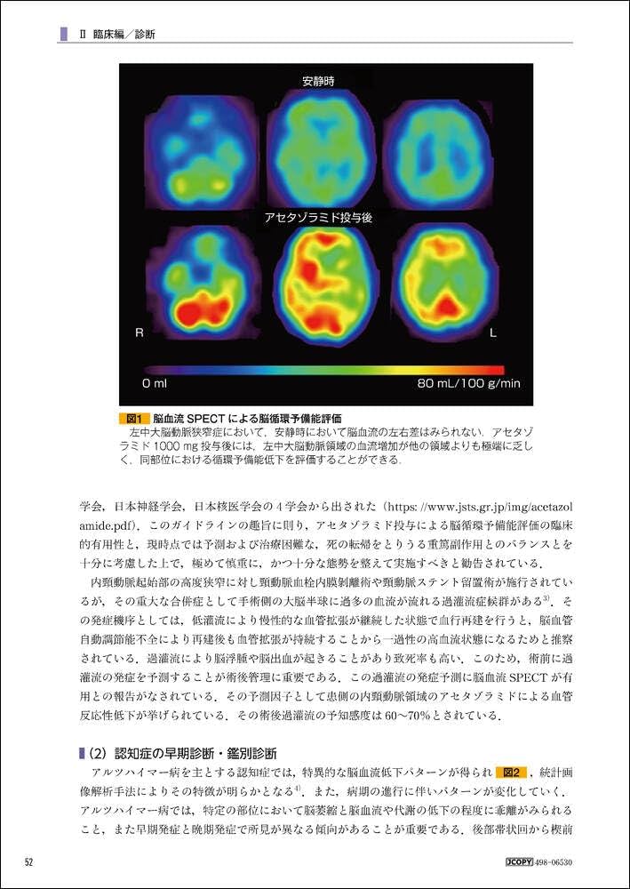 新 核医学テキスト | 絹谷 清剛, 若林 大志 |本 | 通販 | Amazon