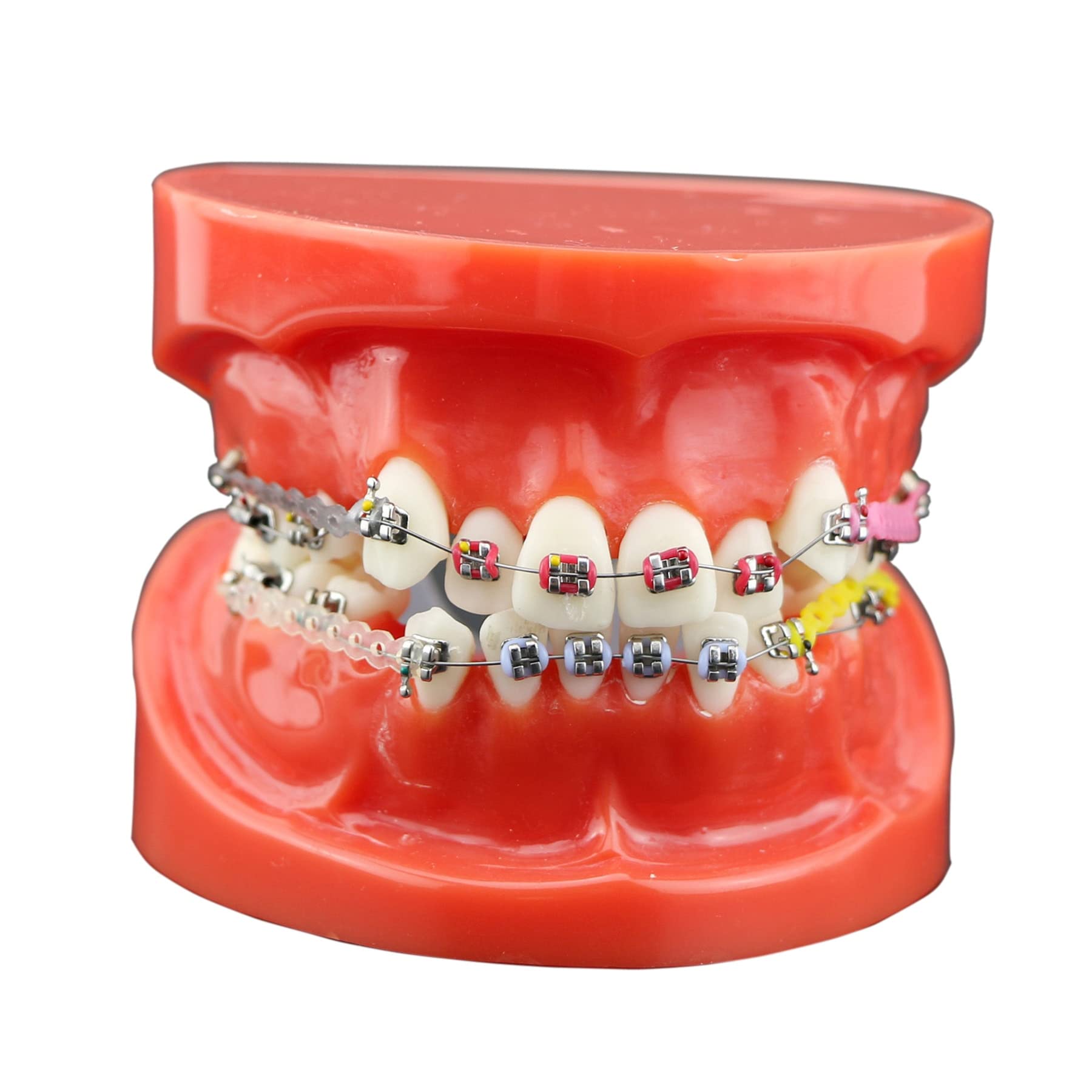 Amazon.co.jp: 歯科模型歯列矯正模型 ブラケットモデル パワーチェーン