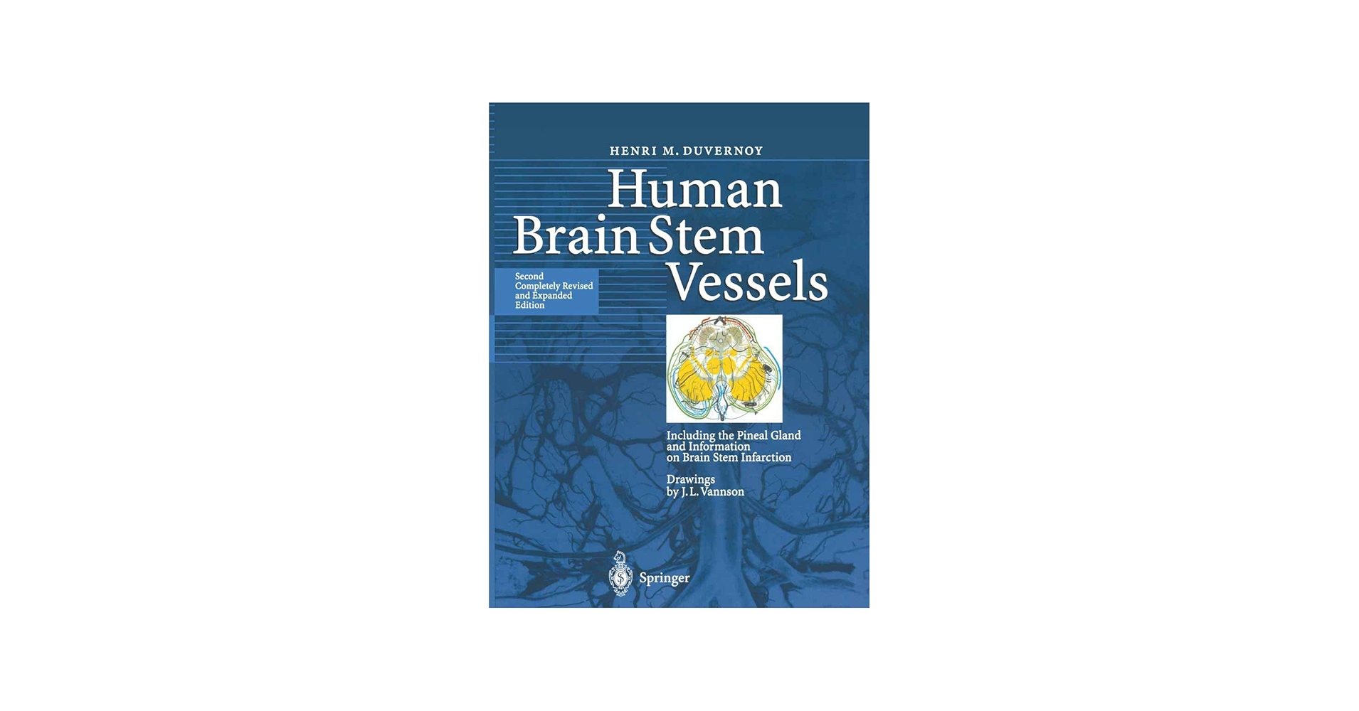 Human Brain Stem Vessels: Including the Pineal Gland and