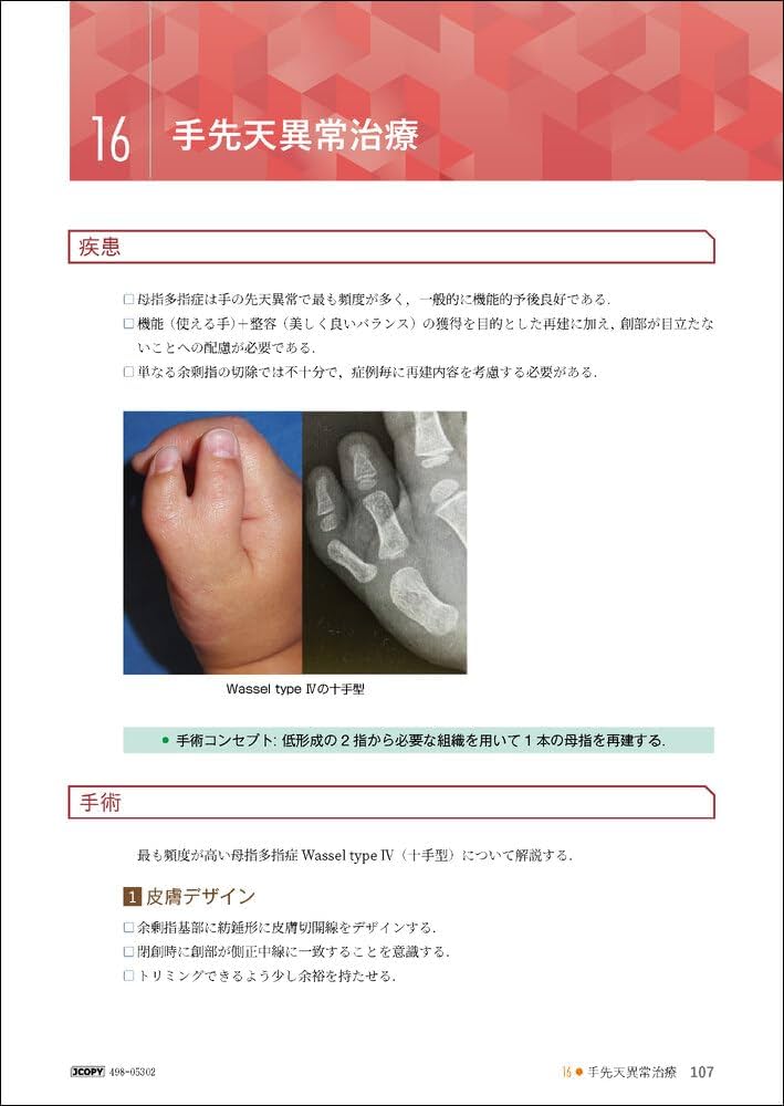 アトラス形成外科手術－見てわかるエキスパートのテクニック－ | 小川