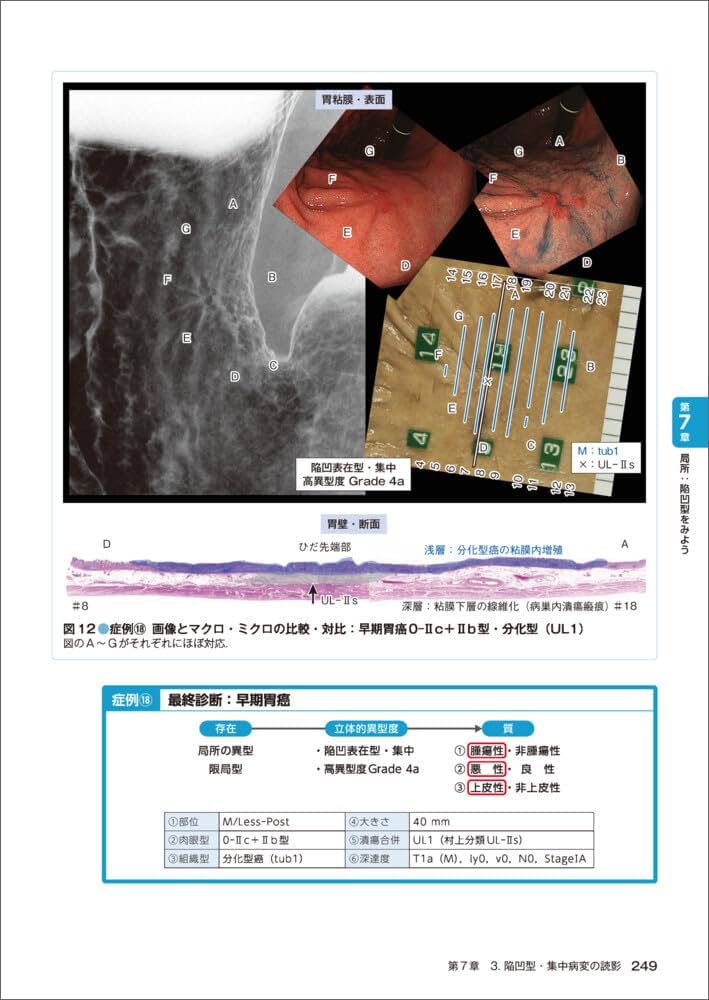 これなら見逃さない！胃X線読影法 虎の巻 改訂版〜シェーマ＋内視鏡像