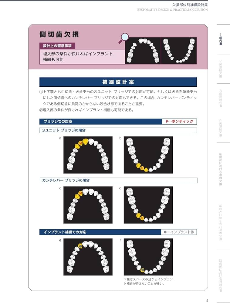 RESTORATIVE DESIGN & PRACTICAL OCCLUSION 補綴設計&設計集 | 本多