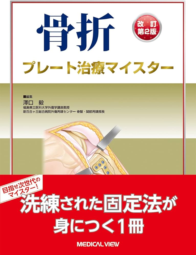 骨折 プレート治療マイスター−改訂第2版 | 澤口 毅 |本 | 通販 | Amazon