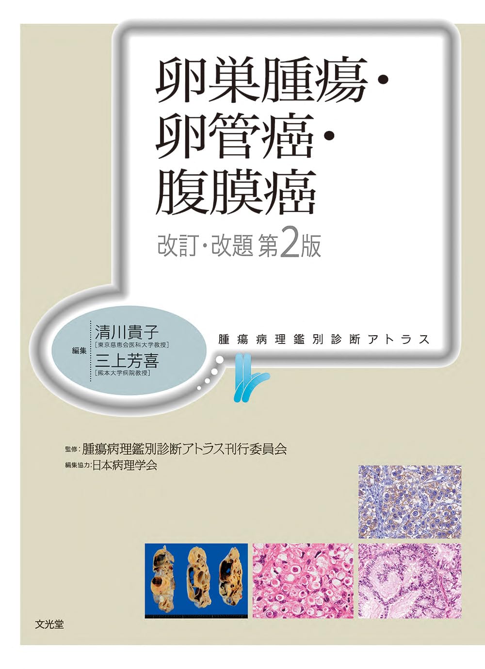 卵巣腫瘍・卵管癌・腹膜癌 改訂・改題第2版(腫瘍病理鑑別診断アトラス
