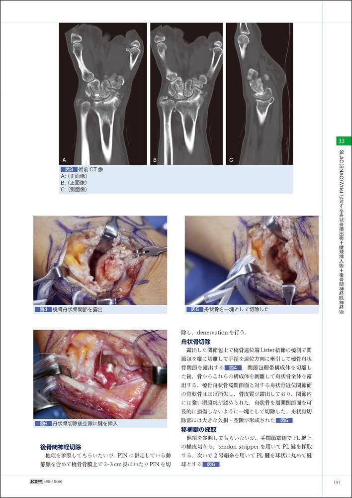 手の外科―私のアプローチ 第3版 | 三浪 明男 |本 | 通販 | Amazon