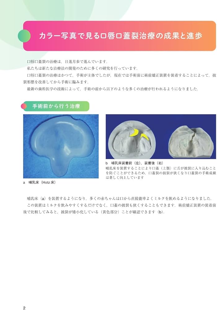 口唇口蓋裂Update: 患者・保護者と,寄り添う医療職のためのQ&A | 夏目