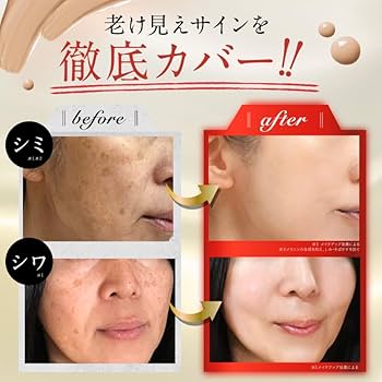 Amazon | 【シミ改善×シワカバー】リノクル ナイアシンアミド リンクル