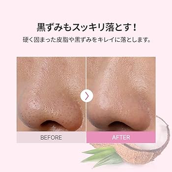 Amazon | BANILA CO バニラコ クリーン イット ゼロ クレンジング