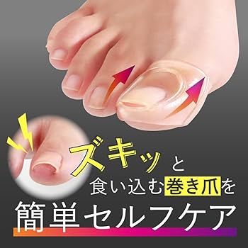 Amazon | アルファックス 巻爪保護 巻き爪ケア 巻き爪ゲルエイド 2個