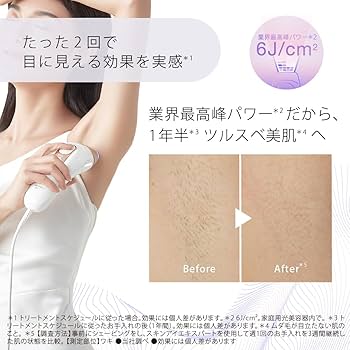 Amazon.co.jp: 【正規品】ブラウン 脱毛器 シルクエキスパート Pro5