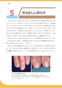 知っておきたい爪の知識と病気: すべての疑問を解決します! | 東 禹彦