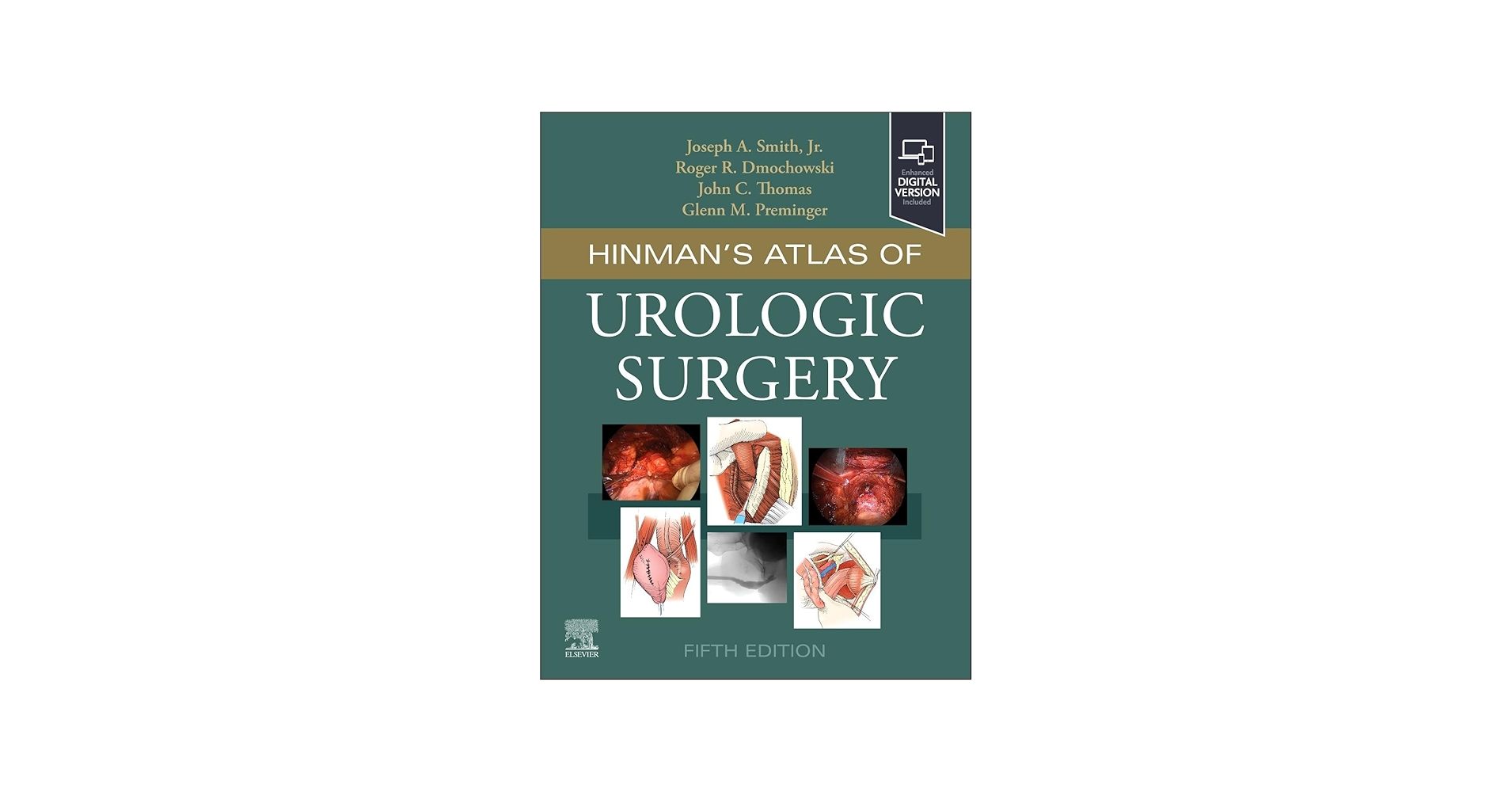 Hinman's Atlas of Urologic Surgery: 9780323936118: Medicine