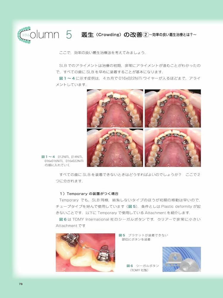 実践的リンガルブラケット矯正 | 松野 功 |本 | 通販 | Amazon