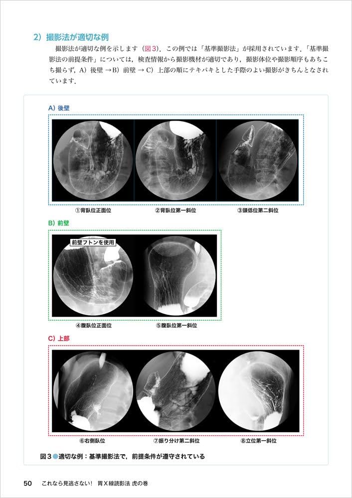 シェーマ＋内視鏡像＋病理像で一目瞭然！ これなら見逃さない！ 胃X線