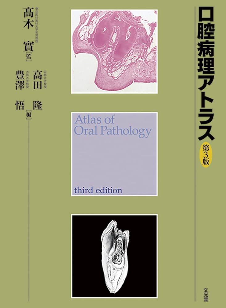 口腔病理アトラス | 高木 實, 高田 隆, 豊澤 悟 |本 | 通販 | Amazon