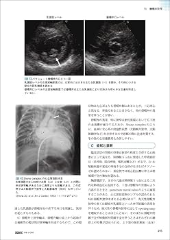 新 発達心臓病学 | 中西 敏雄, 先崎 秀明, 山岸 敬幸 |本 | 通販 | Amazon