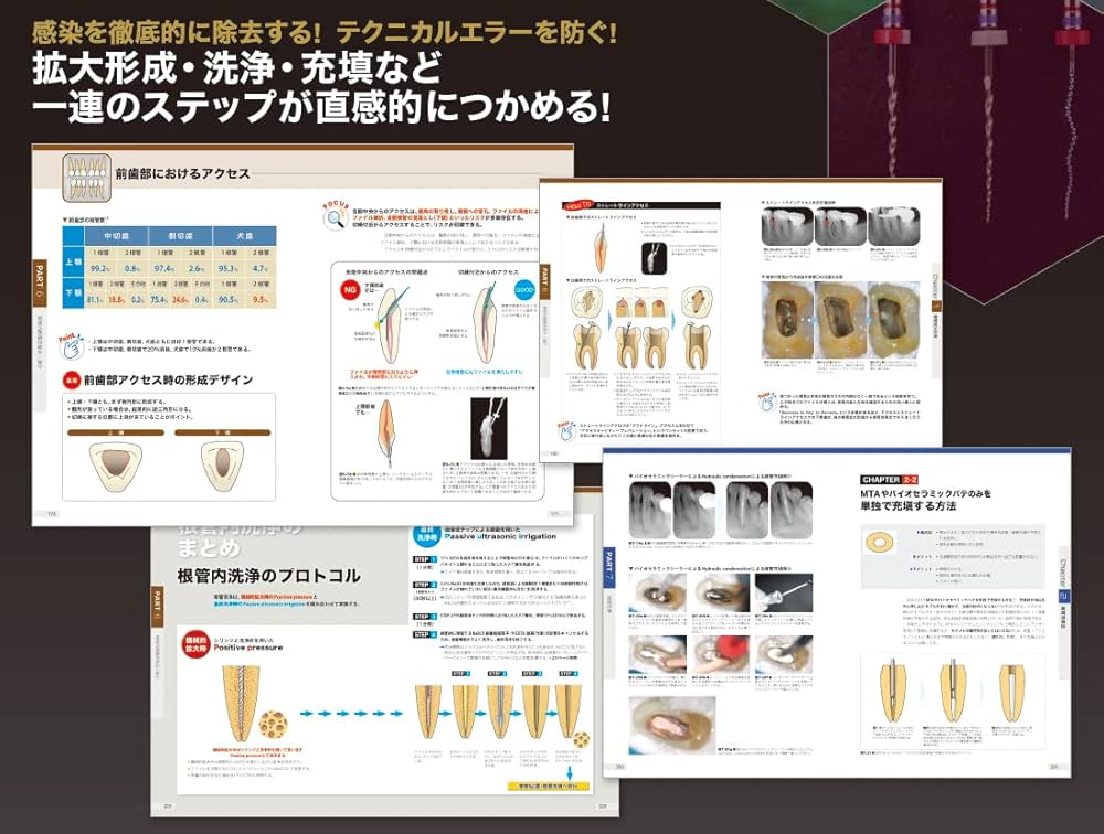 ビジュアル歯内療法学: 生物学的コンセプトとテクニックのすべて