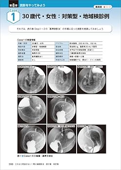 これなら見逃さない！胃X線読影法 虎の巻 改訂版〜シェーマ＋内視鏡像