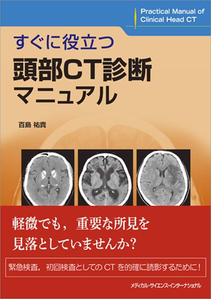 すぐに役立つ頭部CT診断マニュアル | 百島祐貴 |本 | 通販 | Amazon