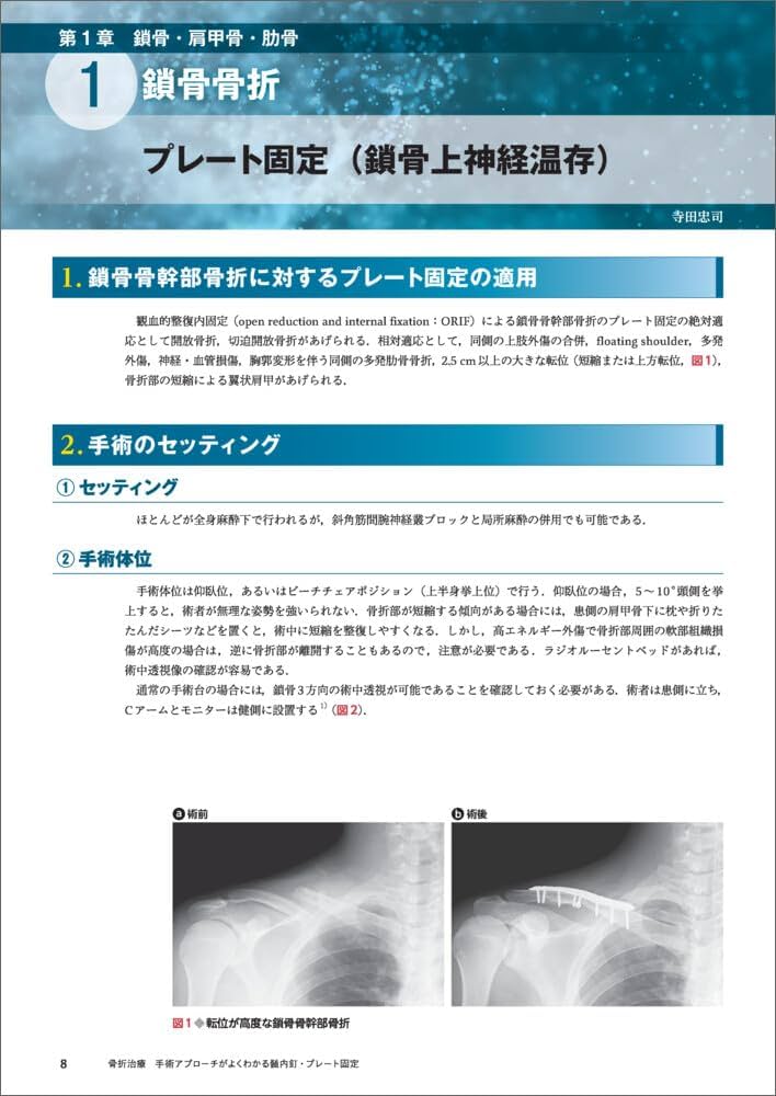 骨折治療 手術アプローチがよくわかる髄内釘・プレート固定 | 渡部 欣