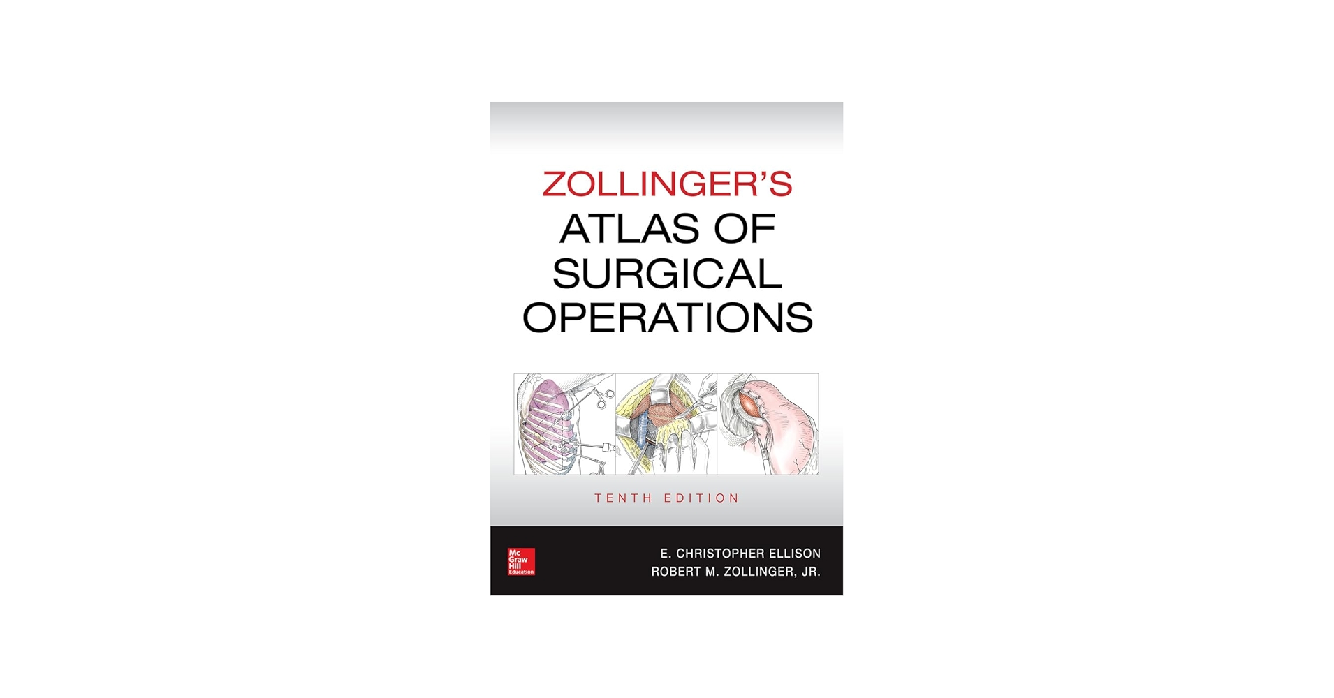 Zollinger's Atlas of Surgical Operations, Tenth Edition