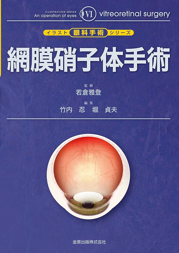 網膜硝子体手術 (イラスト眼科手術シリーズ 6) | 若倉 雅登, 竹内 忍