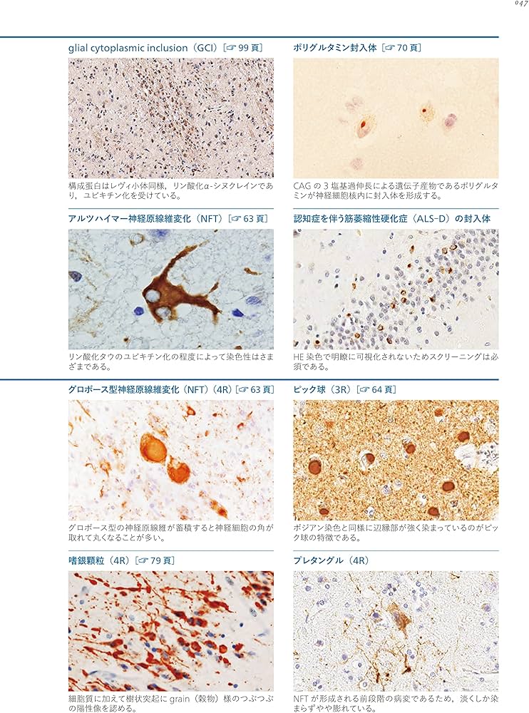 神経病理インデックス 第2版 | 新井信隆, 新井信隆 |本 | 通販 | Amazon