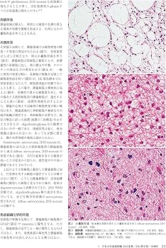脳腫瘍臨床病理カラーアトラス 第4版 | 日本脳腫瘍病理学会, 若林俊彦