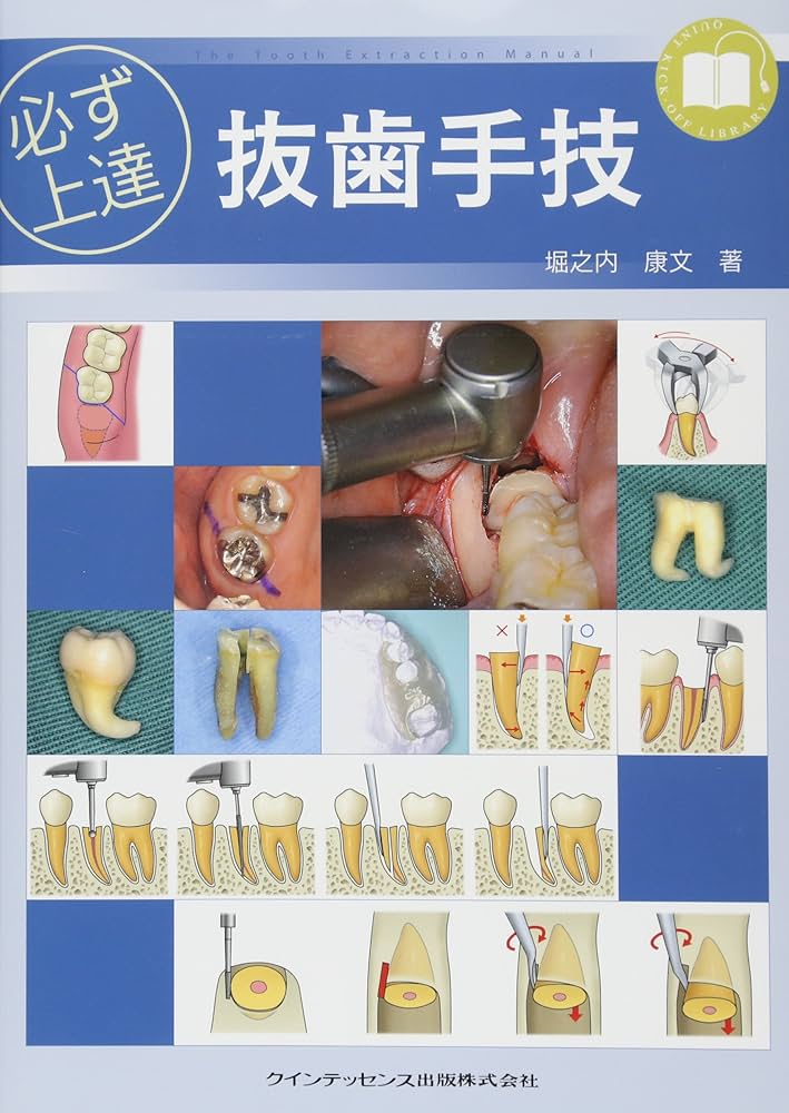 必ず上達 抜歯手技 | 堀之内 康文 |本 | 通販 | Amazon