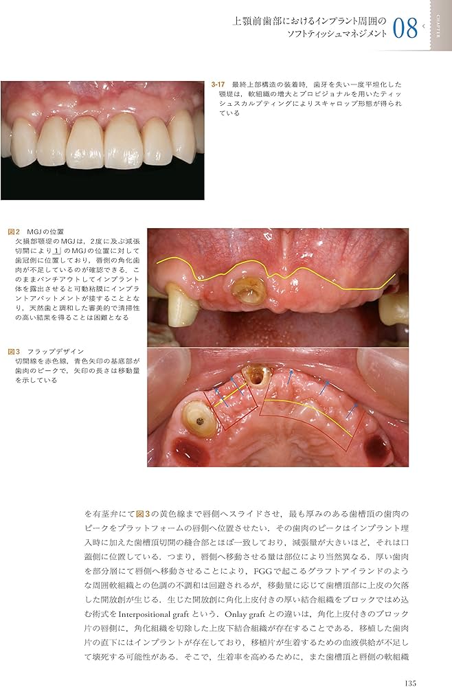 The Fabric of the Modern Implantology 近代インプラント治療の