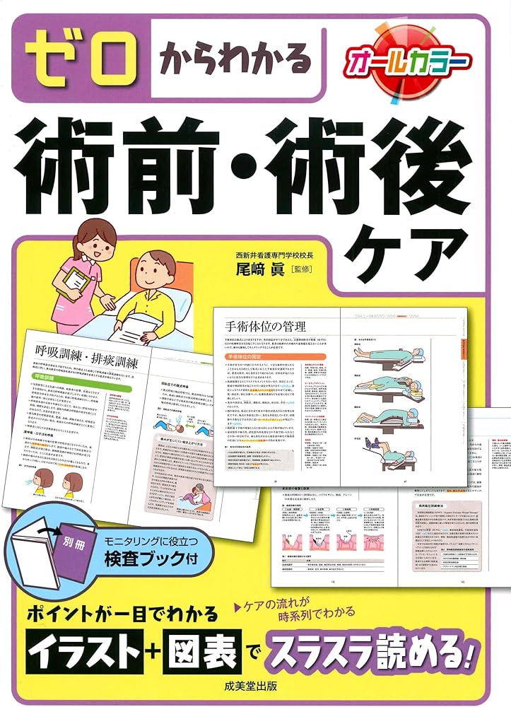 Amazon.co.jp: ゼロからわかる 術前・術後ケア : 尾﨑 眞: 本