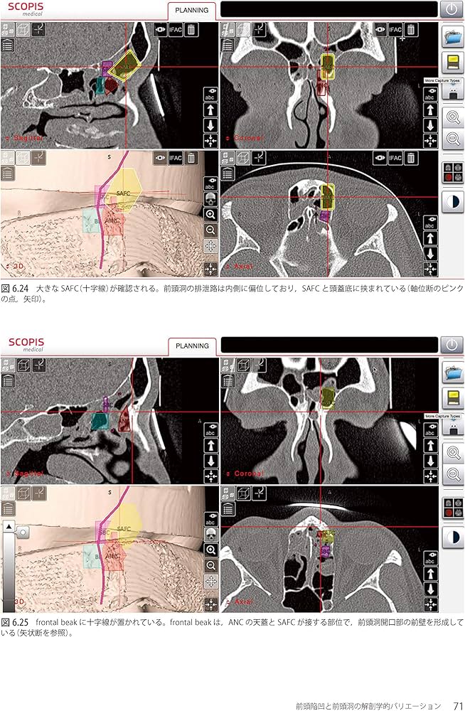 Amazon.co.jp: ウォーモルド内視鏡下鼻副鼻腔・頭蓋底手術 : 本間 明宏: 本