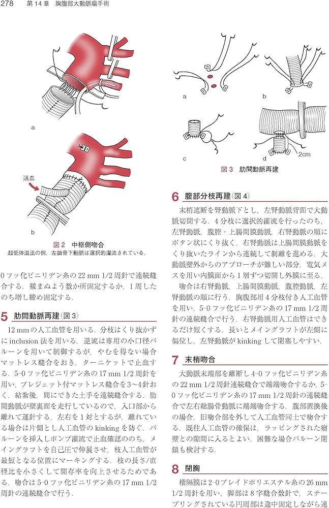心臓・大動脈外科手術 基本・コツ・勘所 心臓・大動脈外科手術: 基本
