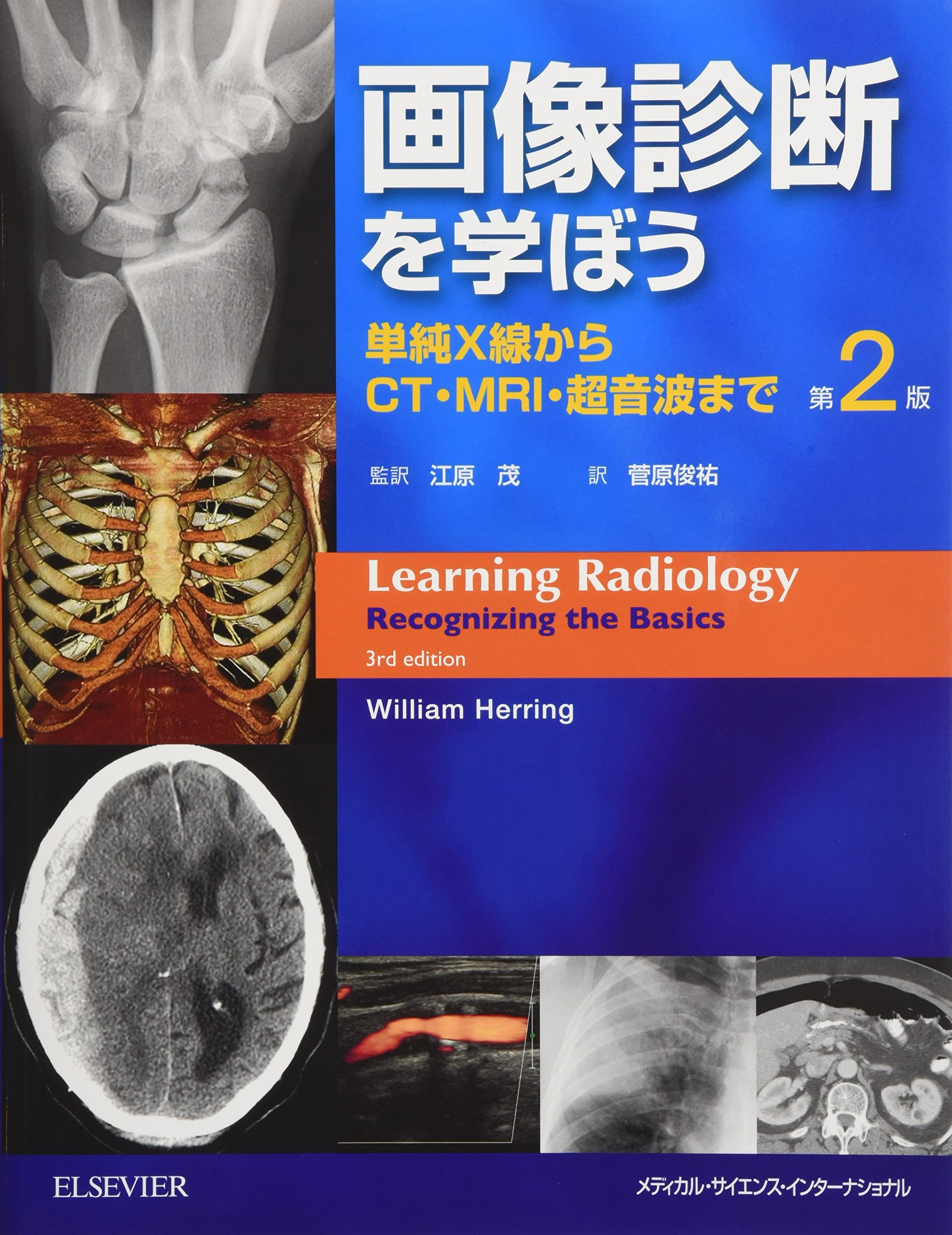 画像診断を学ぼう 単純X線からCT・MRI・超音波まで 第2版 | 江原 茂