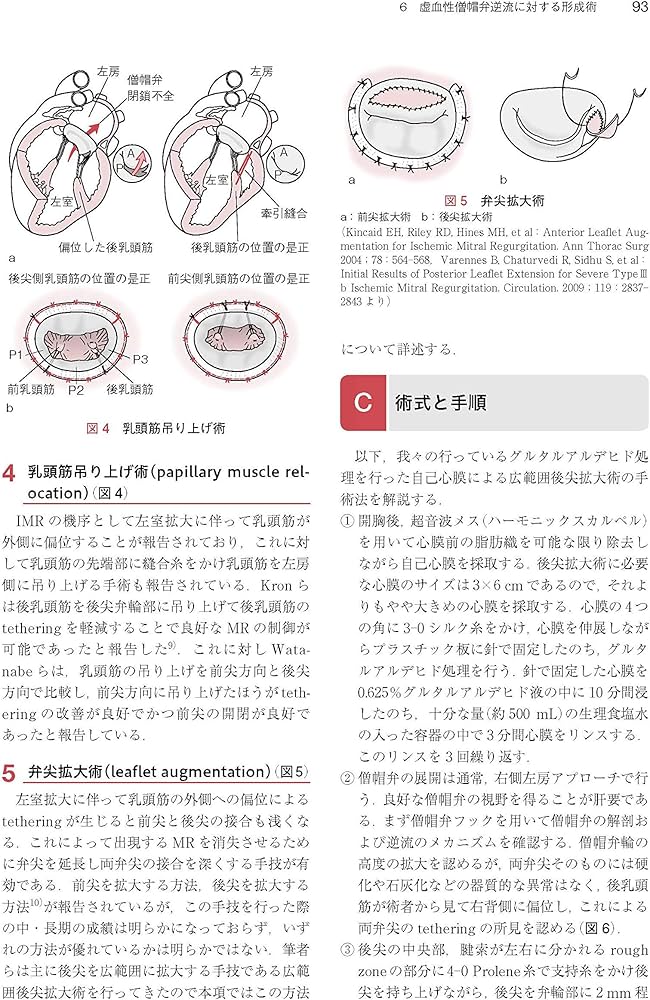 心臓・大動脈外科手術: 基本・コツ・勘所 | 小坂 眞一 |本 | 通販 | Amazon