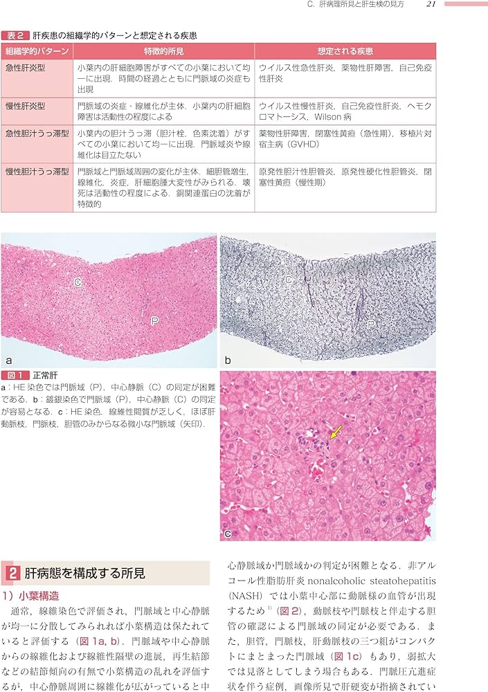 肝胆膵 (非腫瘍性疾患病理アトラス) | 原田 憲一, 能登原 憲司 |本