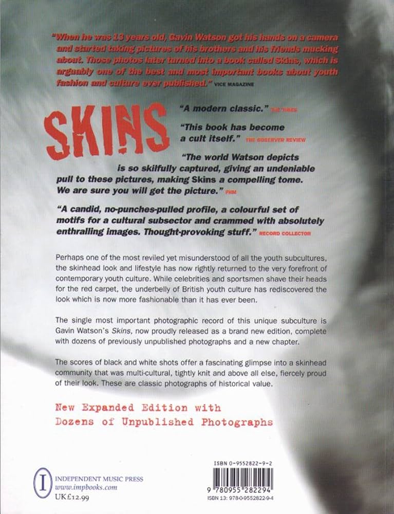 Skins: Gavin Watson: 9780955282294: Amazon.com: Books
