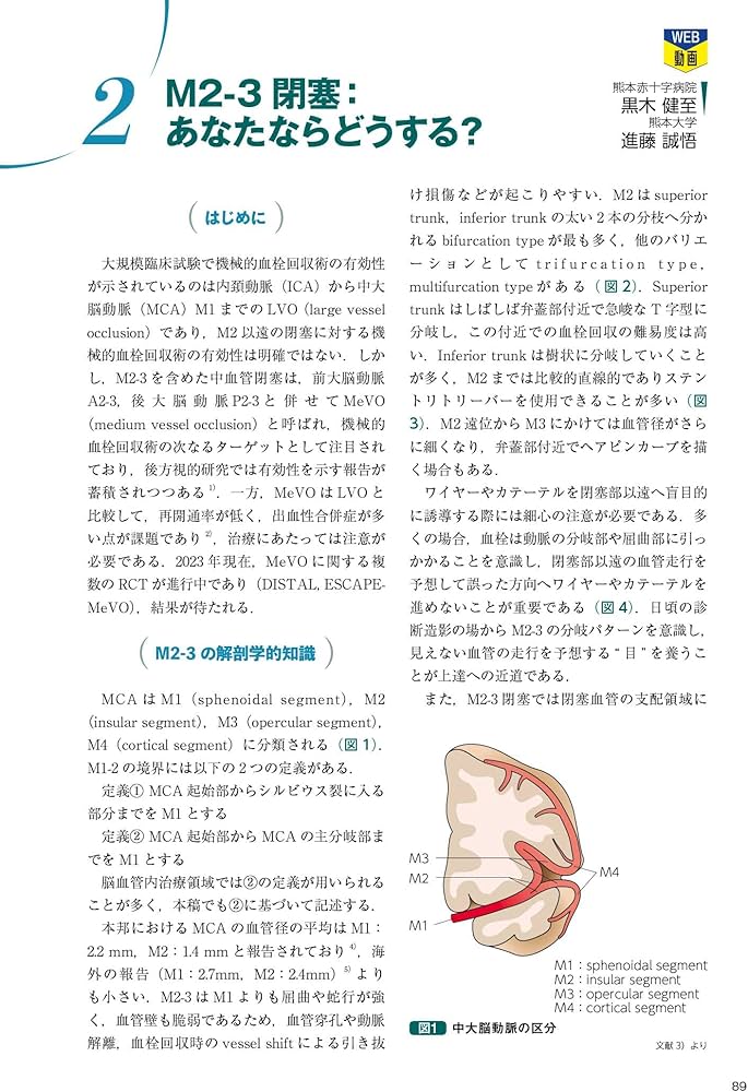 改訂2版 血栓回収療法Technical Tips：治療の引き出しを増やす！／手技
