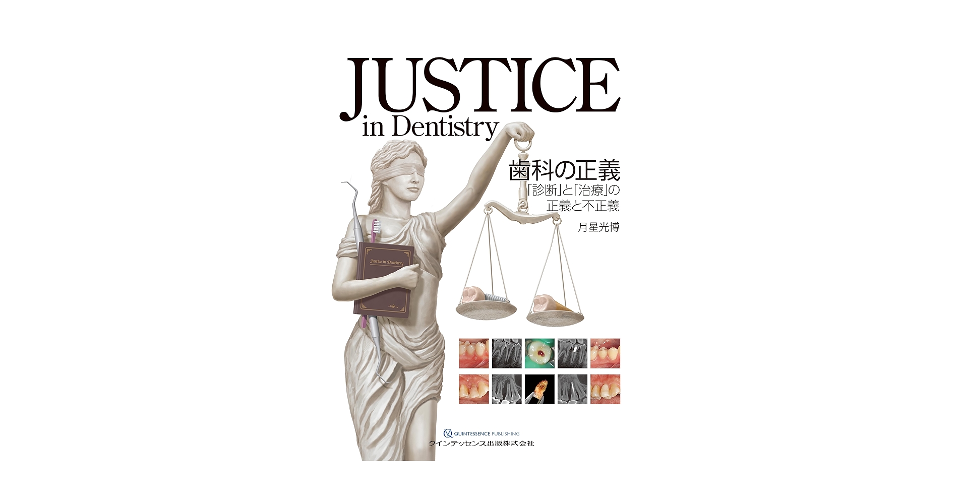 Amazon.co.jp: JUSTICE in Dentistry 歯科の正義: 「診断」と「治療