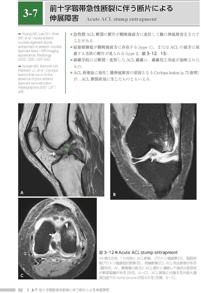 膝MRI 第3版 | 新津 守 |本 | 通販 | Amazon