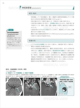 頭部 画像診断の勘ドコロNEO | 田岡 俊昭 |本 | 通販 | Amazon