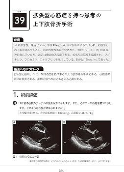 819-FZ1DMbL._AC_UF350,