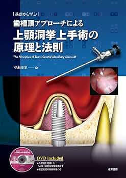 81+OW8WdZaS._AC_UF350,