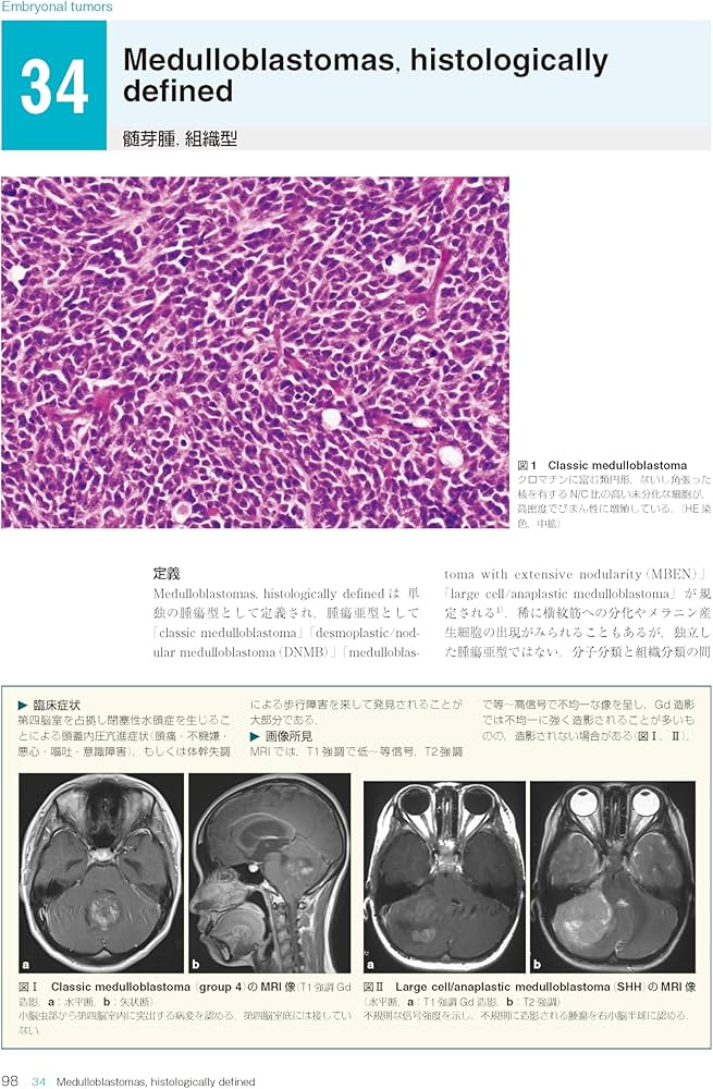 Amazon.co.jp: 脳腫瘍臨床病理カラーアトラス 第5版 : 日本脳腫瘍病理