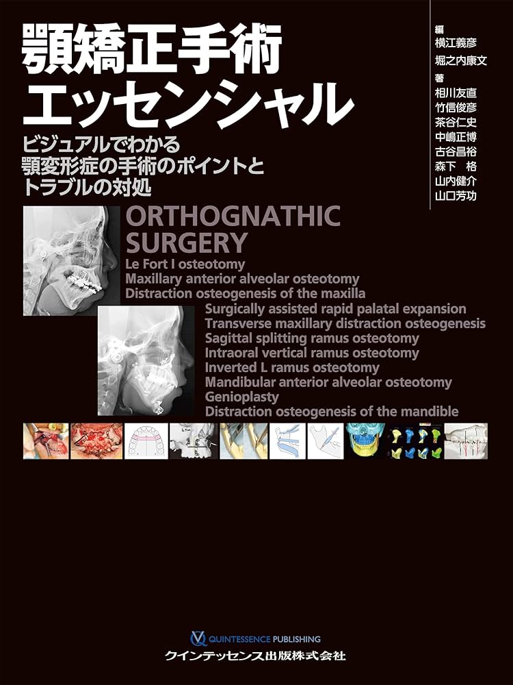 顎矯正手術エッセンシャル | 相川 友直, 竹信 俊彦, 茶谷 仁史, 中嶋
