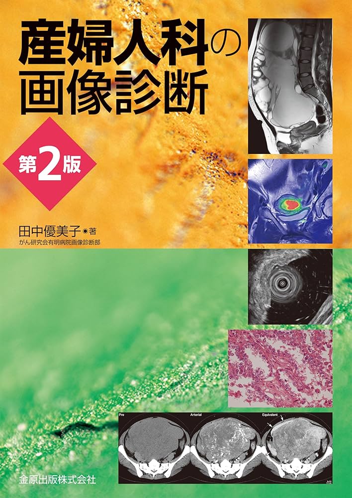 産婦人科の画像診断 第2版 | 田中 優美子 |本 | 通販 | Amazon