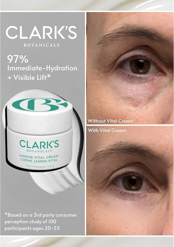 Amazon.com: Clark's Botanicals Jasmine Vital Healing Cream, Anti