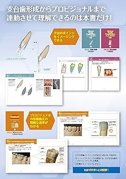 Clinical Provisional Restoration: VISUALプロビジョナル・レスト