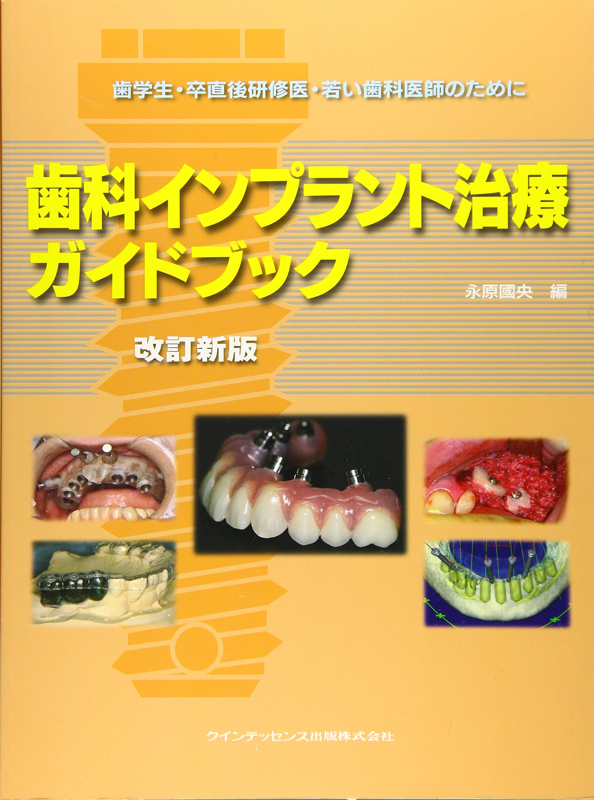 改訂新版 歯科インプラント治療ガイドブック | 永原 國央 |本 | 通販