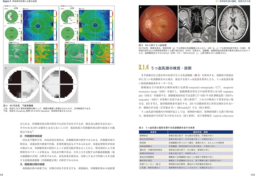 最新 神経眼科エッセンスマスター―診察の基本と疾患別の診療の実際